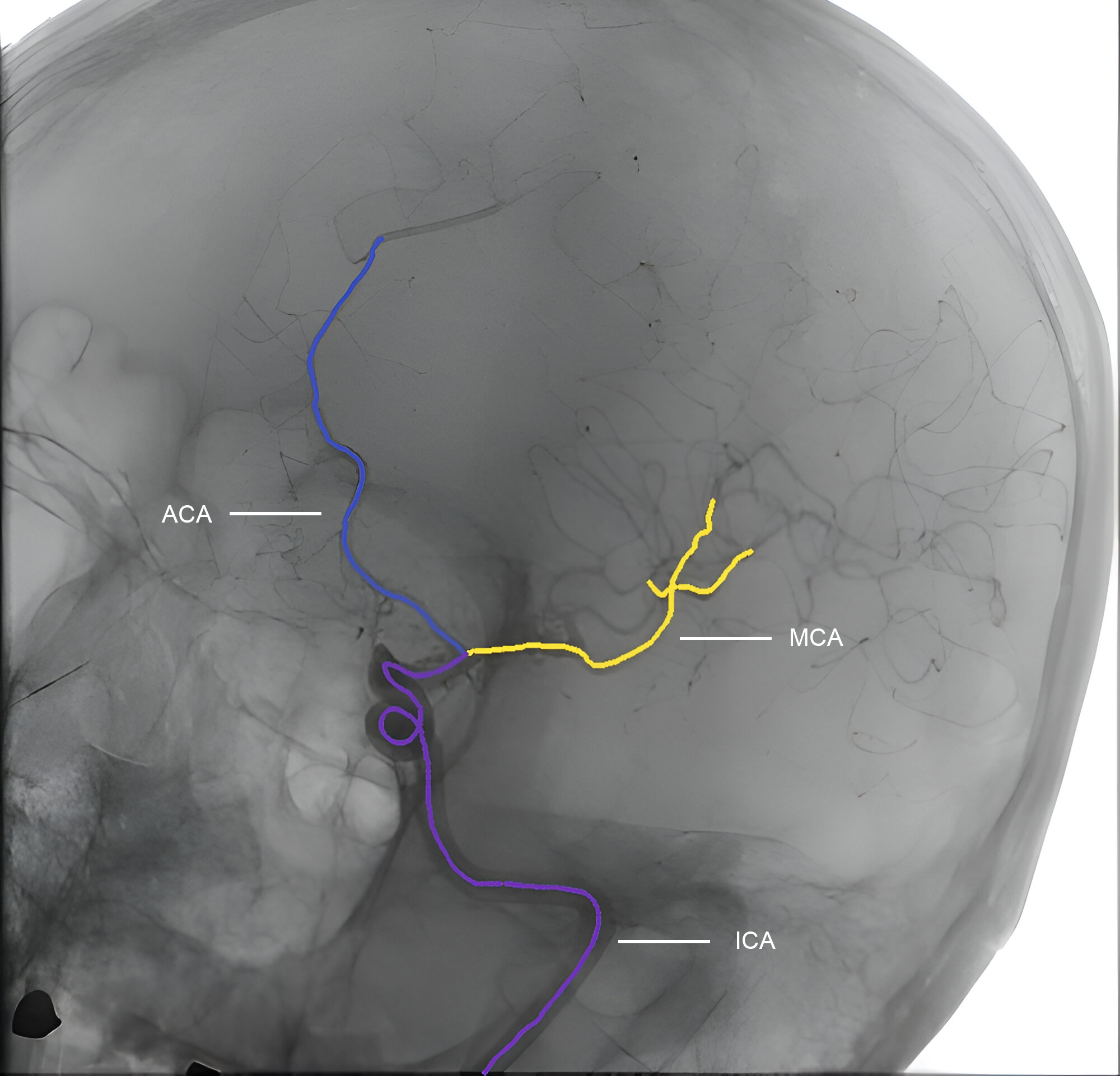 medical Data annotataion